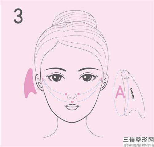 做去法令纹术可保持的时间有多久