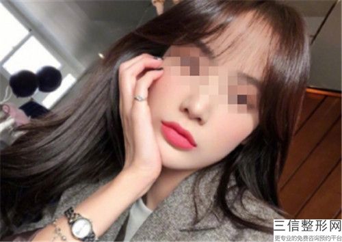 bbl祛斑整形效果会更好-bbl祛斑的效果是长久的吗