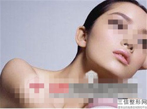 玻尿酸丰耳垂整形作用维持时间几个月