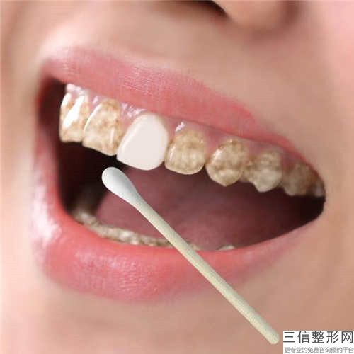 宁海县哪个牙科医院做百康特种植牙好（宁波市宁海县非常好医院口腔科实力口碑过硬）