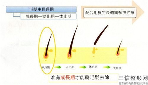 头顶秃植发整形的适合人士有哪些