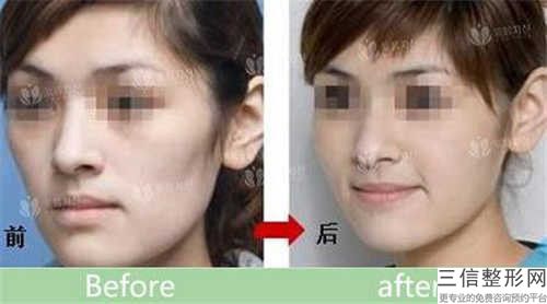 江西省三甲医院下颚骨歪推荐：下颚骨歪医院前30强预测