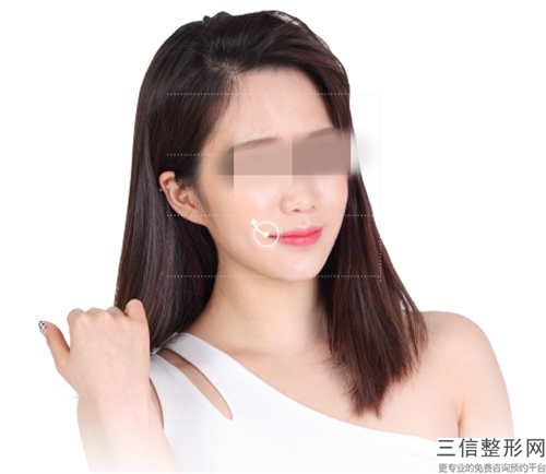 日照市哪个整形医院做完唇裂手术比较好(日照秀美颜医疗美容门诊部优势分析)