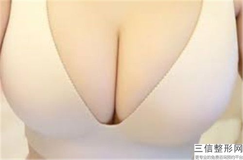 傲诺拉水滴假体隆胸矫正比较好的年龄是什么时候