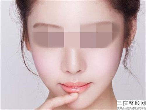 日照市提拉面部去皱纹安全的医生(何茂文医生技术靠谱吗)