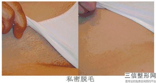 中国做脱毛比较有名的医生：做脱毛医生前50佳良心表更新