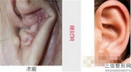 焦作市美容医院耳朵整形整-焦作市耳朵整形整医院上榜清单前十名哪家口碑好
