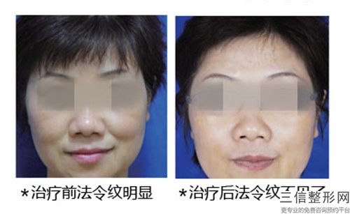 打除皱国内哪家医院好：打除皱医院50强多领域总结