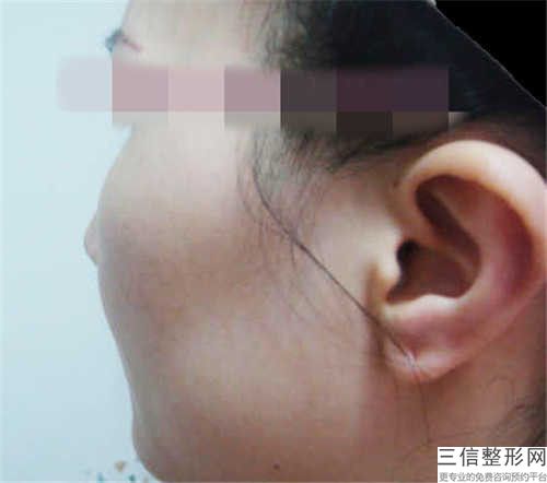 盘锦辽河油田中心医院-医疗美容科削脸颊骨资质人气医生-附整形价格表(费用)