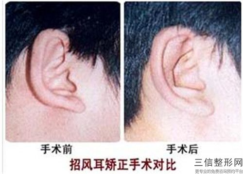 安阳市手术耳垂修复医生排行top10强规模对比-黄学峰医生技术比拼