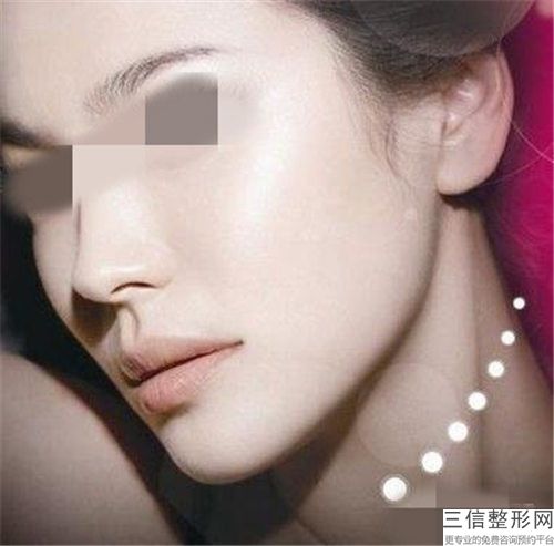 大理白族自治州好的双下巴精雕吸脂医院排行-大理大学非常好附属医院医学美容整形科网友点评好