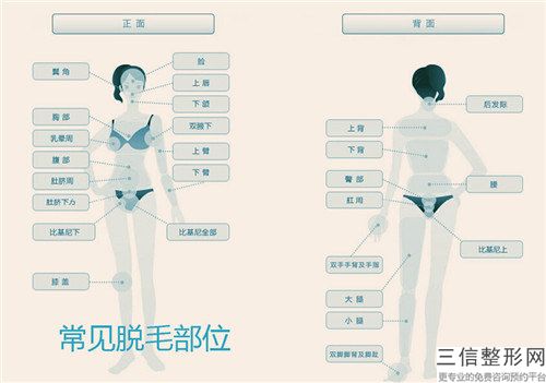 镭射脱毛术有什么后遗症「镭射脱毛会有什么后遗症」