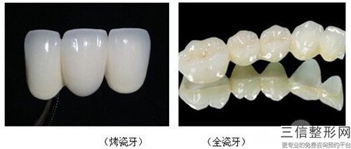 潍坊牙科整牙手术适宜人群和禁忌人群