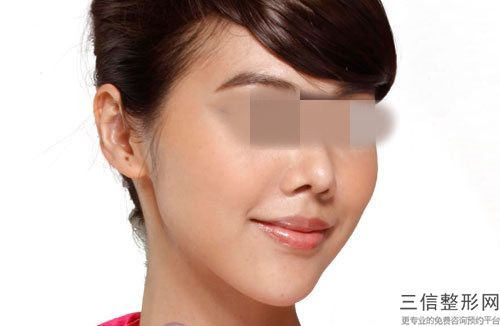 上海市美容医院垫下巴用玻尿酸推荐：垫下巴用玻尿酸医院top30强网友良心安利