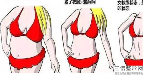 连云港美缔整形医院臀部吸脂塑形手术过程和适应人群