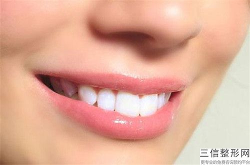 宜春纠正牙齿歪的误区和副作用
