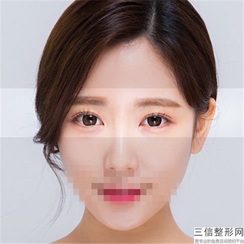 海口外凸牙齿对眼球会有伤害吗