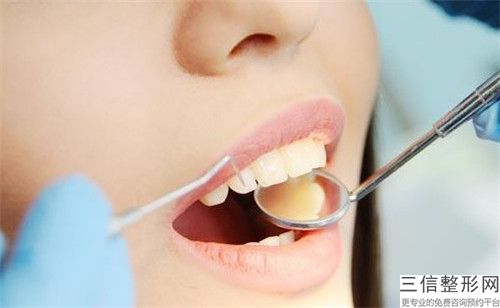 南京烤瓷牙整容术后护理需要注意哪些问题