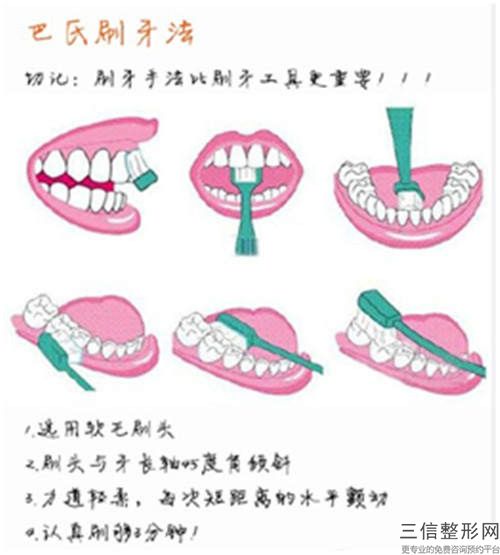汕头华美医疗美容医院满嘴烂牙后有什么后遗症