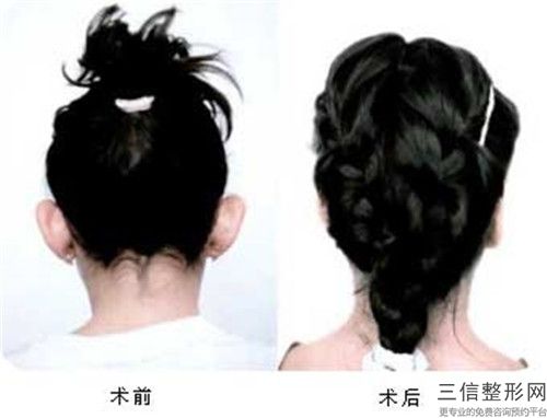 扬州市精灵耳怎么整形专业医院-扬州市精灵耳怎么整形医院排名榜前10强榜详细分析