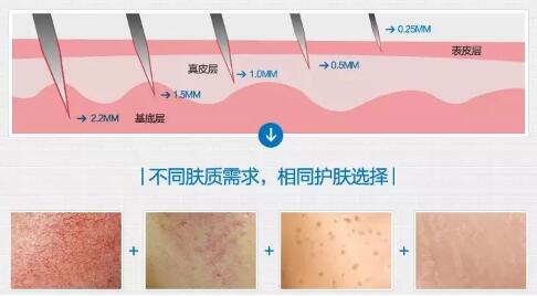 菲洛嘉/美塑疗法多少钱_菲洛嘉/美塑疗法整形手术价格